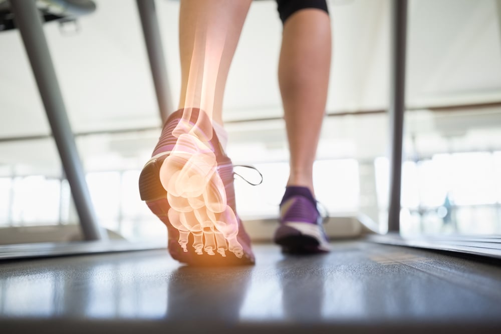 Digital composite of Highlighted foot bones of jogging woman Digital composite of Highlighted foot bones of jogging woman